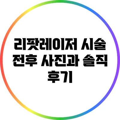 리팟레이저 시술 전후 사진과 솔직 후기